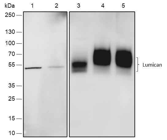 Anti-Human/Rat/Mouse Lumican Antibody [A552] - ABMIUM