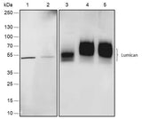 Anti-Human/Rat/Mouse Lumican Antibody [A552]