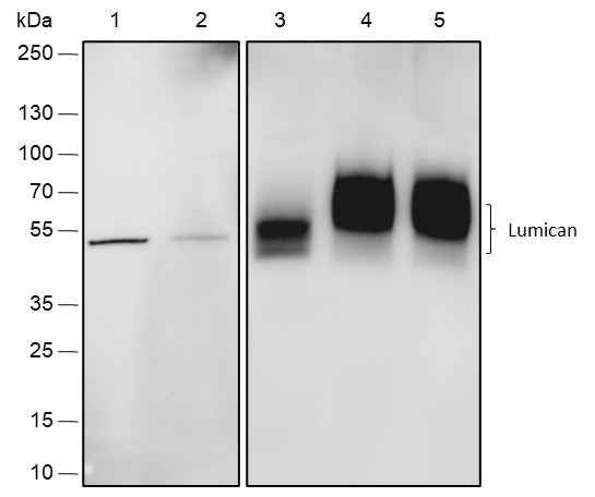 Anti-Human/Rat/Mouse Lumican Antibody [A552]