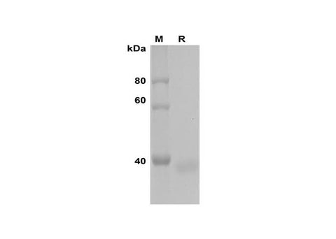 SDS-PAGE analysis of Human MYL1 proteins, 2 μg/lane of Recombinant Human MYL1 proteins was resolved with SDS-PAGE under reducing conditions, showing bands at 38 kDa.