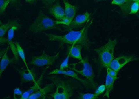 Anti-Human DCX Antibody [A928] - ABMIUM