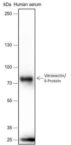 Anti-Human Vitronectin/S-Protein Antibody [A389] - ABMIUM
