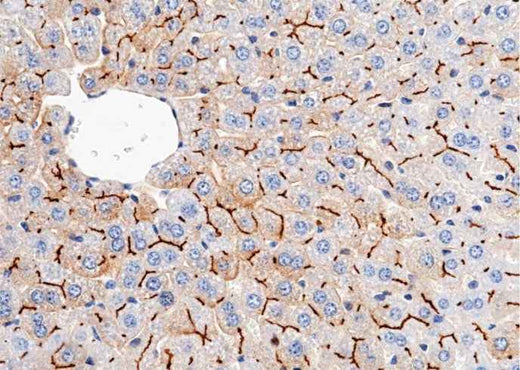 Anti-Mouse CEACAM1 Antibody [B464] - ABMIUM
