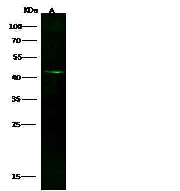 Anti-Human GFAP Antibody [A1254] - ABMIUM