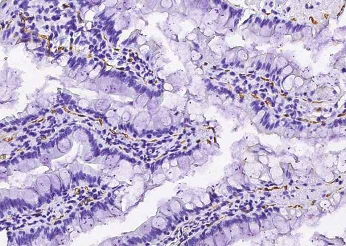 Anti-Rat CD36 Antibody [B523] - ABMIUM