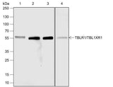 Anti-Human/Rat/Mouse TBLR1/TBL1XR1 Antibody [A640]