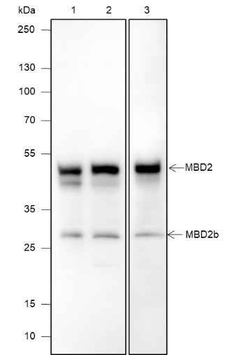 Anti-Human/Rat/Mouse MBD2 Antibody [A621]