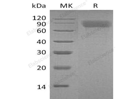 Recombinant Mouse Thrombopoietin/TPO Protein (His Tag) - ABMIUM