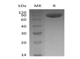 Recombinant Human OX-2/MOX1/CD200 Protein (Fc Tag) - ABMIUM