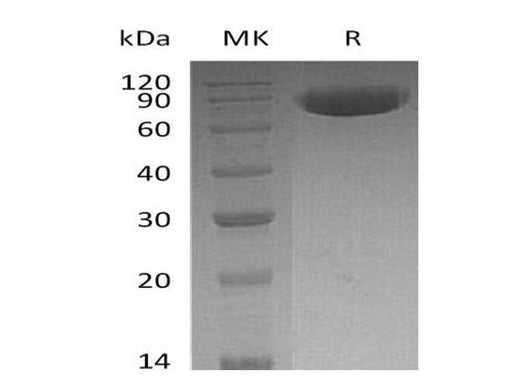Recombinant Human OX-2/MOX1/CD200 Protein (Fc Tag) - ABMIUM