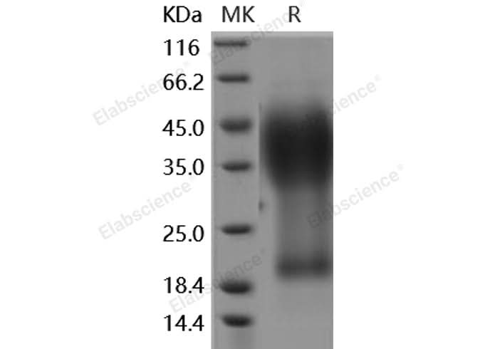 Recombinant Human GYPA/CD235a/Glycophorin A Protein (His Tag) - ABMIUM