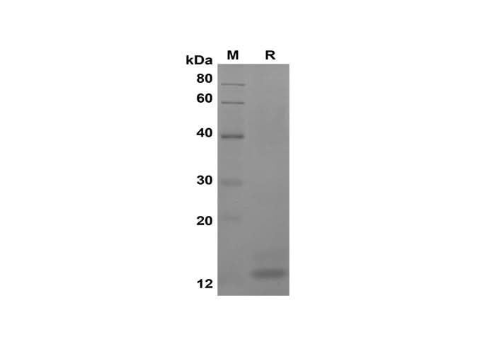 SDS-PAGE analysis of Human CD247/CD3-ZETA proteins, 2 μg/lane of Recombinant Human CD247/CD3-ZETA proteins was resolved with SDS-PAGE under reducing conditions, showing bands at 13 kDa.