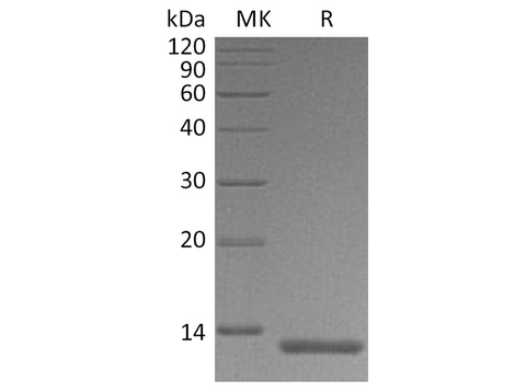 Recombinant Human S100A4 Protein (His Tag) - ABMIUM