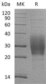 Recombinant Mouse TREM2 Protein (His Tag) - ABMIUM