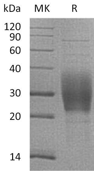Recombinant Mouse TREM2 Protein (His Tag) - ABMIUM