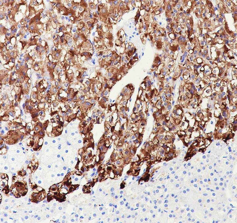 Anti-Human Dopamine beta Hydroxylase Antibody [A691] - ABMIUM