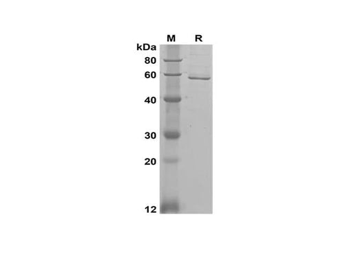 SDS-PAGE analysis of Human AMY1A proteins, 2 μg/lane of Recombinant Human AMY1A proteins was resolved with SDS-PAGE under reducing conditions, showing bands at 58 kDa.