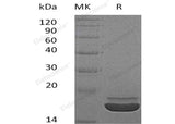 Recombinant Human RARRES2/TIG2 Protein (His Tag) - ABMIUM