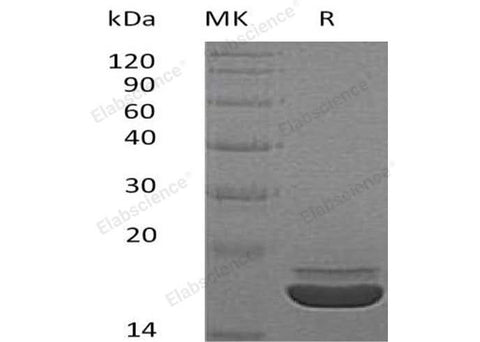 Recombinant Human RARRES2/TIG2 Protein (His Tag) - ABMIUM