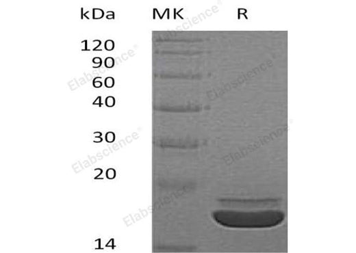 Recombinant Human RARRES2/TIG2 Protein (His Tag) - ABMIUM
