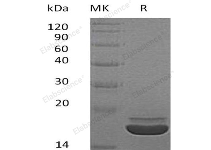 Recombinant Human RARRES2/TIG2 Protein (His Tag) - ABMIUM