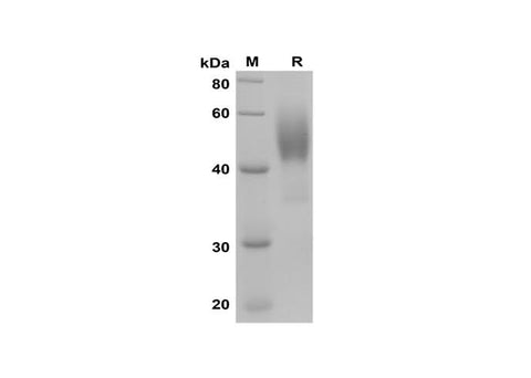 SDS-PAGE analysis of Human PVRL1/NECTIN1/CD111 proteins, 2 μg/lane of Recombinant Human PVRL1/NECTIN1/CD111 proteins was resolved with SDS-PAGE under reducing conditions, showing bands at 40-60 kDa.