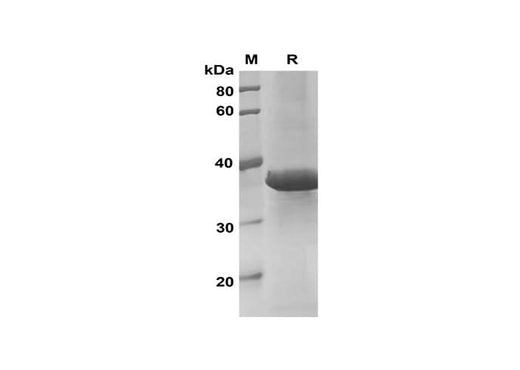 SDS-PAGE analysis of Mouse IL-17D proteins, 2 μg/lane of Recombinant Mouse IL-17D proteins was resolved with SDS-PAGE under reducing conditions, showing bands at 38 kDa.