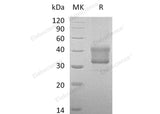 Recombinant Human TNFRSF1B/CD120b Protein (aa 288-461, His Tag) - ABMIUM