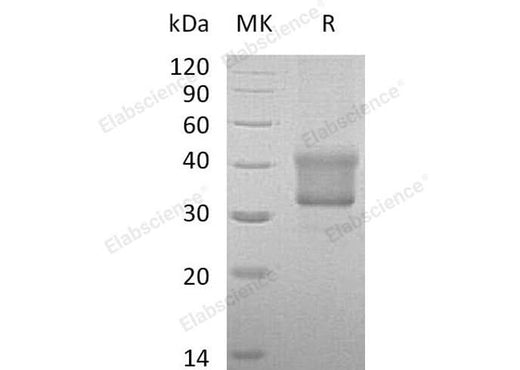 Recombinant Human TNFRSF1B/CD120b Protein (aa 288-461, His Tag) - ABMIUM