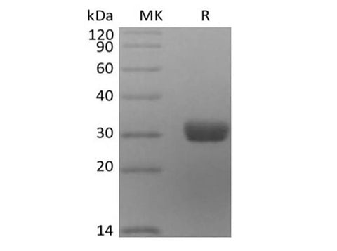 Recombinant Human Angiopoietin-2/ANG2 (C-6His) - ABMIUM