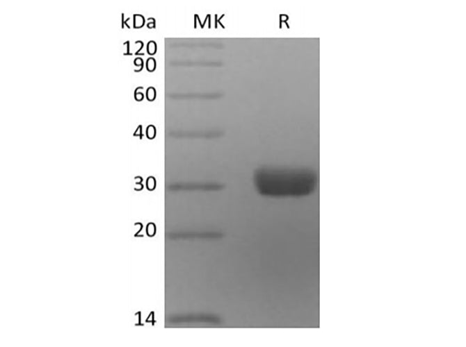 Recombinant Human Angiopoietin-2/ANG2 (C-6His) - ABMIUM