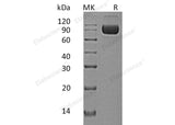 Recombinant Human IL-1RAcP/IL1R3 Protein (Fc & His Tag) - ABMIUM