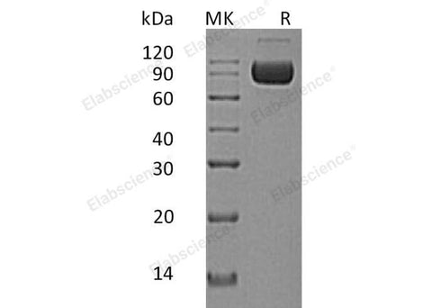 Recombinant Human IL-1RAcP/IL1R3 Protein (Fc & His Tag) - ABMIUM