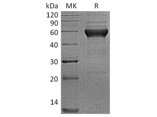 Recombinant Human ALK-1/ACVRL1 Protein (Fc Tag) - ABMIUM