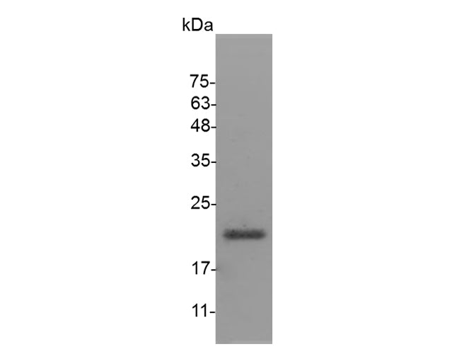 Recombinant Mouse IL-28B protein(His Tag) - ABMIUM