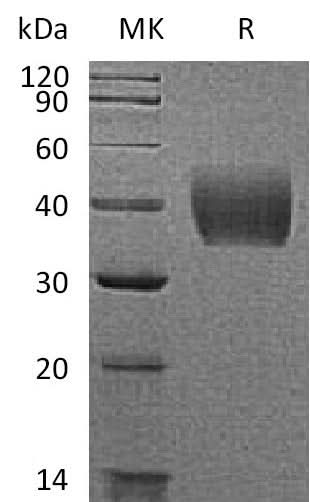 Recombinant Mouse Tissue Factor/TF Protein (His Tag) - ABMIUM