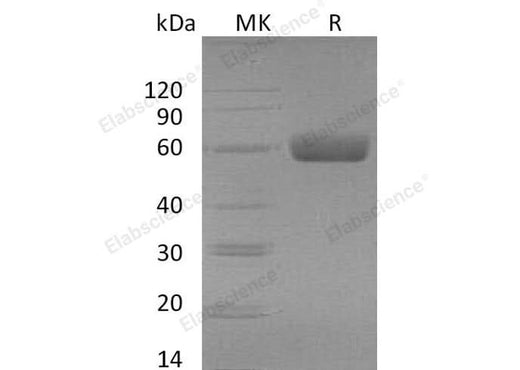 Recombinant Mouse TGFBR2 Protein (Fc Tag) - ABMIUM