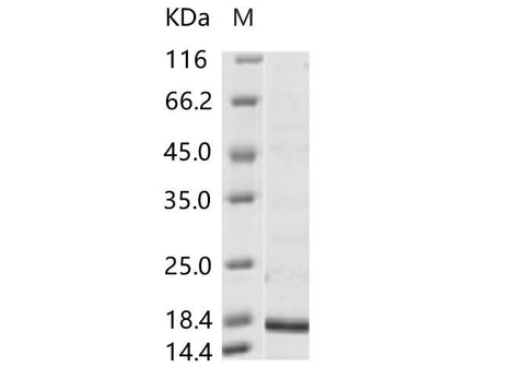 Recombinant Hepatitis B Virus (HBV)(ayw/France/Tiollais/1979) Capsid protein (His Tag) - ABMIUM