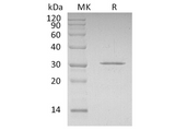 Recombinant Human CDKN1B Protein (His Tag) - ABMIUM