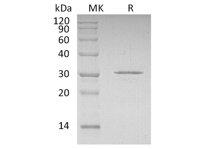 Recombinant Human CDKN1B Protein (His Tag) - ABMIUM