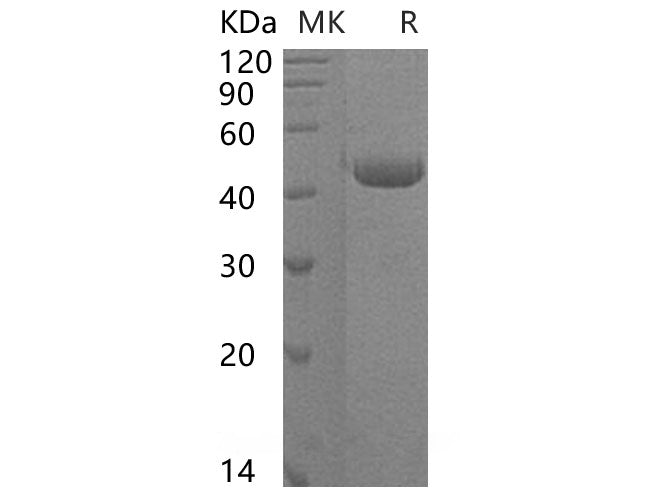 Recombinant Human ST6GALNAC2 Protein (His Tag) - ABMIUM