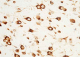 Anti-Human SerpinF2 Antibody [B237]