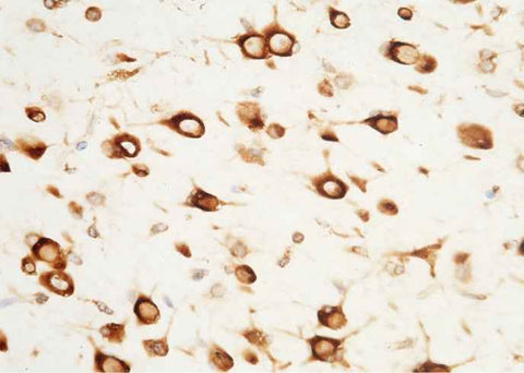 Anti-Human SerpinF2 Antibody [B237] - ABMIUM