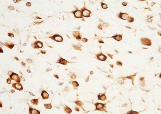 Anti-Human SerpinF2 Antibody [B237] - ABMIUM