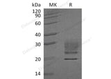 Recombinant Human Ribonuclease A/RNASE1 Protein (His Tag) - ABMIUM