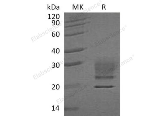 Recombinant Human Ribonuclease A/RNASE1 Protein (His Tag) - ABMIUM