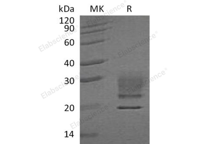 Recombinant Human Ribonuclease A/RNASE1 Protein (His Tag) - ABMIUM