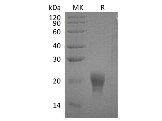 Recombinant Human Interleukin-5/IL-5 Protein (His Tag) - ABMIUM