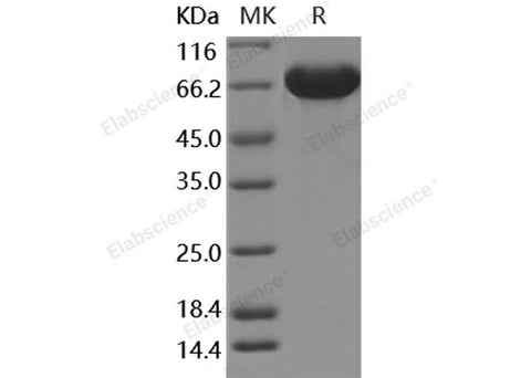 Recombinant Human A1BG/alpha 1B-Glycoprotein Protein (His Tag) - ABMIUM