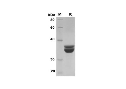 SDS-PAGE analysis of Human SOD2 proteins, 2 μg/lane of Recombinant Human SOD2 proteins was resolved with SDS-PAGE under reducing conditions, showing bands at 36 kDa.